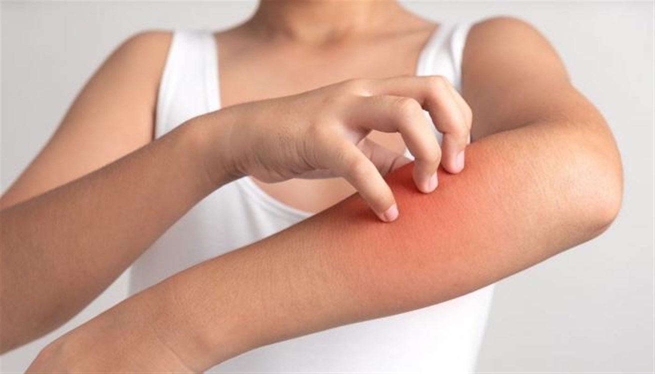 133-201038-summer-skin-infections-sun_700x400240718110900944~